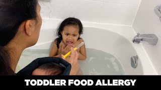 WHAT TO DO  TODDLER FOOD ALLERGY DA CHIN SHOW [upl. by Yajet467]