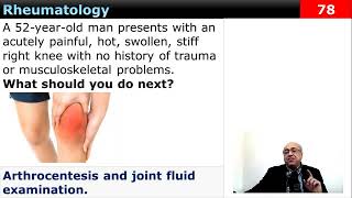 internalmedicine cme usmle محاضراتباطنة ecg كورساتباطنة clinical clinical medicine [upl. by Waiter]