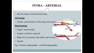 Intra Arterial Route of Drug Administration Injection [upl. by Irfan570]