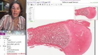 Popular Classic F13 Endochondral ossification [upl. by Omora]