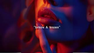 Rill  Hickeys amp Bruises Official Audio [upl. by Klement]