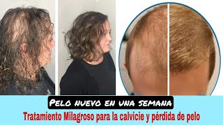 Esta mezcla RECUPERARÁ el cabello que perdiste😭 Cabello fino Calvicie y Crecimiento GARANTIZADO❗️ [upl. by Gwynne938]