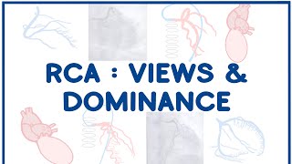 Right Coronary Artery Angiogram Views amp Dominance [upl. by Stoecker]