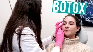 BOTOX FOREHEAD  First Time [upl. by Atsira]