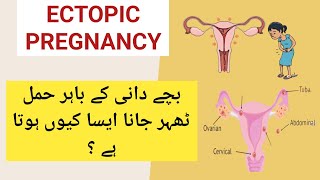 Ectopic Pregnancy Inside Fallopian Tube Mein Hamal Hona Cuases Symptoms Treatment in Urduhindi [upl. by Shirk]