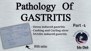 Gastritis  Acute Gastritis  Stress Ulcers  Cushing ulcer Curling ulcer  GI Pathology [upl. by Boser]