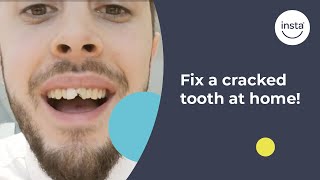 Covering Cracked amp Chipped Teeth  Instasmile Review [upl. by Naltiak]