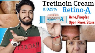 Retino A 0025 Cream Review  Tretinoin Cream Review [upl. by Agneta]