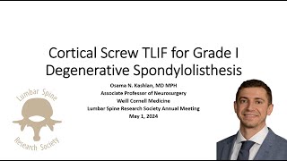 Cortical Screw TLIF for Grade 1 Degenerative Spondylolisthesis [upl. by Gitlow]