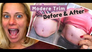 Modere Trim Before and After pictures [upl. by Thornton806]