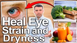 How To Heal Eye Strain  Causes and Solutions [upl. by Korie]