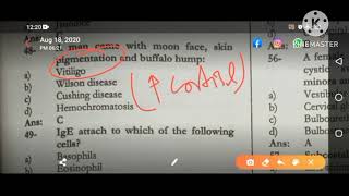 How to Differentiate Between Cushing Disease Vs Cushing SyndromeDrjehangirkhan fcps1mbbs [upl. by Dionisio]