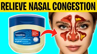 8 Ways To Naturally Relieve Nasal Congestion [upl. by Ettessil]