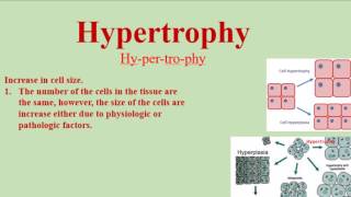 Hypertrophy Pronunciation and Definition  How to pronounce hypertrophy [upl. by Peterman]