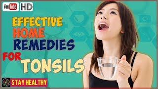 5 Effective Home Remedies For Tonsils [upl. by Esinehc893]