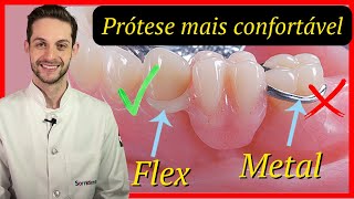 Conheça a Prótese dentária sem grampos metálicos [upl. by Outlaw]