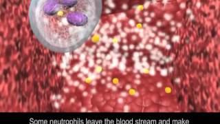 Immune Response to Bacteria [upl. by Jethro771]