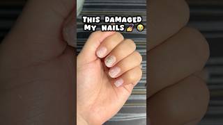 Nail extensions ki galti 😭😭nails nailsextension viralvideo shortsfeed viralshort trending [upl. by Yannodrahc]