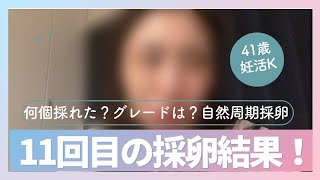 11回目の採卵結果。何個？グレードは？自然周期採卵。不妊治療vlog 40代不妊 アラフォー妊活 採卵高齢妊活 [upl. by Yuhas]