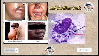 Leishmania parasiteLD bodies test part part1 leishmaniasis diseaseprotozoa in Pashto [upl. by Dimitri]