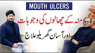 Mouth Ulcer Causes amp Treatment  Muh K Chalon Ka Ilaj  Dr Imran Zia  Dentist [upl. by Carolina338]