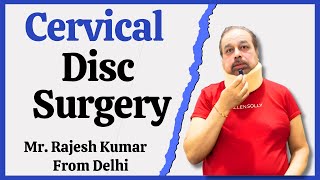 Cervical Disc Surgery  Cervical Spine Treatment in Delhi NCR India [upl. by Eisoj]