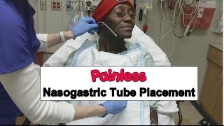 Painless Nasogastric Tube Placement [upl. by Whiffen]