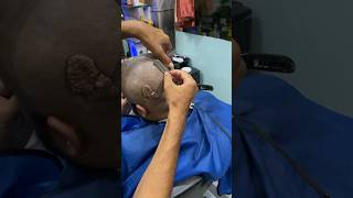 HeadShave before head tumor surgery dandruffheadshave healthyhairjourneycancer 😢part2 [upl. by Ydac413]