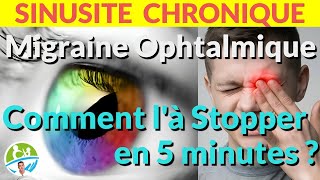 Migraine Ophtalmique Comment là Stopper en 5 minutes ASTUCE [upl. by Fillbert]