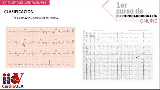 Curso electrocardiografía Tema extrasístoles ventriculares [upl. by Abocaj]