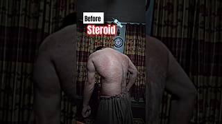 Dont Use Steroids ❌ shortfeed motivation steroidssideeffects viralshort bodybuilding [upl. by Meluhs513]