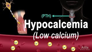 Hypocalcemia Low Calcium Pathology Causes Symptoms and Treatment Animation [upl. by Udell]