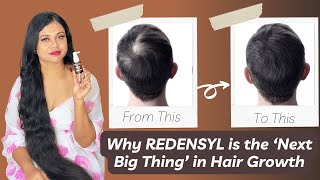 Why REDENSYL is the Next Big Thing in Hair Growth Ft Soulflower Rosemary Redensyl Hair Growth Serum [upl. by Haneen872]