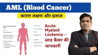 Acute Myeloid Leukemia AML Cause Symptoms Tests and Treatment Explained  Blood Cancer [upl. by Clougher]