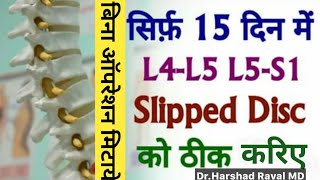 L4 L5 Slip Disc l Herniated Disc l Disc Protruded l Disc Extrusion बिना ऑपरेशन 100 मिटाये कमर दर्द [upl. by Atel752]