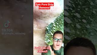 EPIC PORE STRIP REMOVAL  Fruit RollUp Blackhead Removal 😂 shorts [upl. by Fidela]