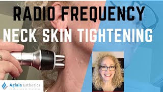 NECK RADIO FREQUENCY TREATMENT  SKIN TIGHTENING [upl. by Doraj230]