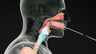 How do Straw Exercises Help the Voice Get Better voicetherapy [upl. by Oralie638]