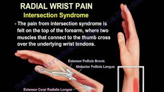 Wrist Paincauses and treatmentPart 2  Everything You Need To Know  Dr Nabil Ebraheim [upl. by Aikemehs]