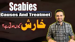 Scabies Ki Pehchan Aur Iska Ilaj \ Dr Shoaib Ke Sath \ The Medbros \ خارش کا علاج [upl. by Legra698]