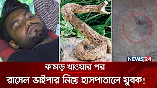 কামড় খাওয়ার পর রাসেল ভাইপার নিয়ে হাসপাতালে যুবক  Russells Viper  Snake  News24 [upl. by Alyss]