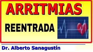 ARRITMIAS 6 REENTRADAS como causa de arritmia cardíaca [upl. by Blackman]