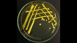 Micrococcus luteus  the most common cleanroom bacterium [upl. by Edgerton]