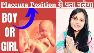 Gender Prediction Symptoms in Pregnancy Posterior Placenta से कैसे पता करे गर्भ में बेटा या बेटी है [upl. by Atelokin]