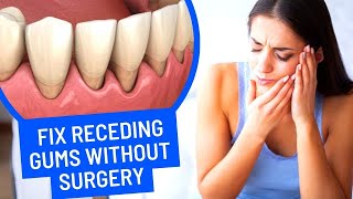 How To Fix Receding Gums Without Surgery  Super Easy Ways [upl. by Annelg594]