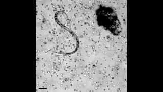 The immune system in action how white blood cells attack a parasitic worm [upl. by Nosyt]