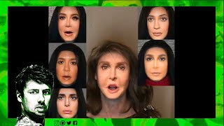 KARDASHIAN FACE SURGERY PROBLEM [upl. by Matthias]