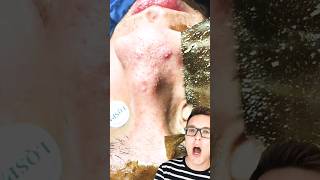 Shocking PORE STRIP REMOVAL  Best One Yet shorts [upl. by Myrtle]