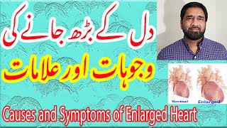 Heart Size  Signs amp Symptoms of enlarged heart  Hypertrophic Heart  Normal Heart in Urdu [upl. by Aranaj]