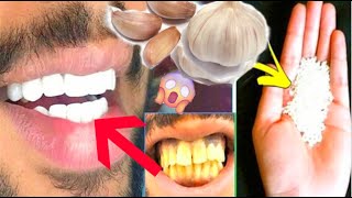 COMMENT BLANCHIR SES DENTS en 5 minutes avec de lail et du sel [upl. by Anilas]